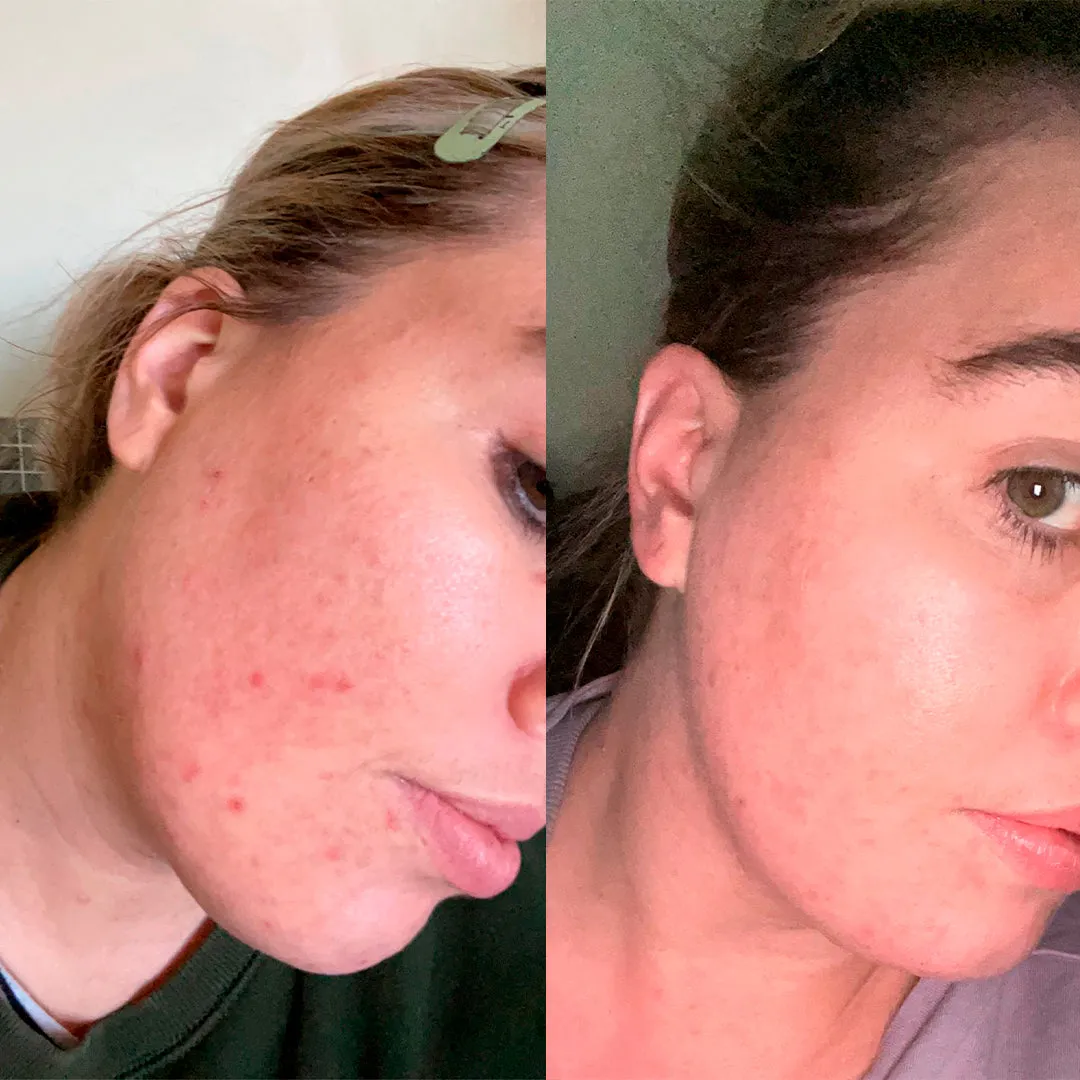 Hydrating Hyaluronic Acid & Vitamin C Face Serum